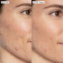 Cargar imagen en el visor de la galería, Sunday Riley Good Genes All-In-One Lactic Acid Treatment