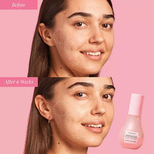 Cargar imagen en el visor de la galería, GLOW RECIPE Watermelon Glow Niacinamide Dew Drops serum