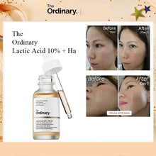 Cargar imagen en el visor de la galería, THE ORDINARY   LACTIC ACID 10% + HA
