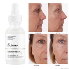 Cargar imagen en el visor de la galería, THE ORDINARY HYALURONIC ACID 2%
